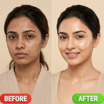 Arencia Vitamin C Booster Shot – Dark Spot Care & Glass Skin Glow – Brightens Skin, Fades Dark Spots, Deep Hydration – Face & Eye Cream Moisturizer – For Radiant, Even-Toned Skin