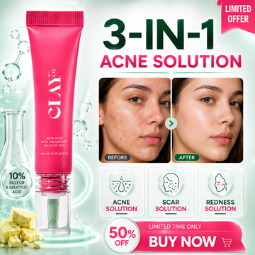 3-in-1 Acne Solution Paste – Overnight Acne, Scar & Redness Solution – Deeply Cleans Pores, Fights Acne, Reduces Inflammation – Fast Relief